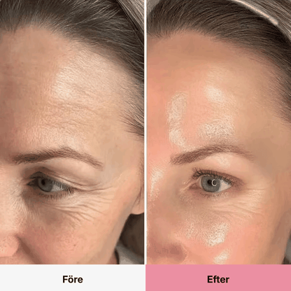 PDRN Collagen Volume Balm 4 RITUEL
