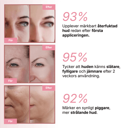 PDRN Collagen Volume Balm 4 RITUEL